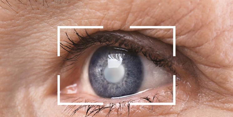 یافته جدید محققان رویان و دانشگاه درسدن آلمان/ کروکتین زعفران بیماری لکه زرد چشم را متوقف می کند