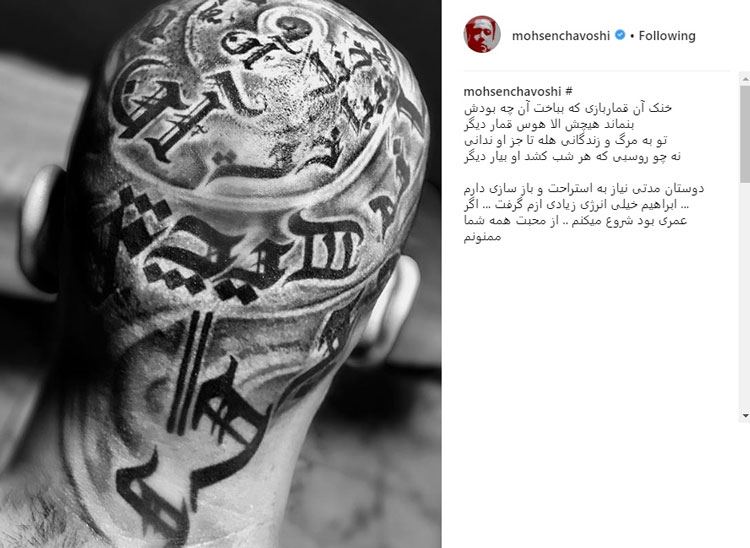 تتوی عجیب روی سر محسن چاوشی
