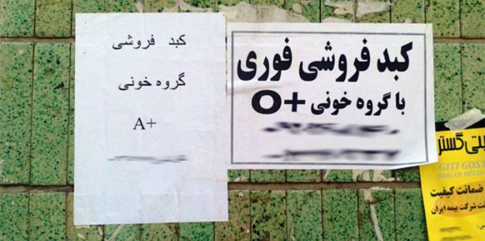 غذاهایی که ترکیب‌شان قاتل کبد است