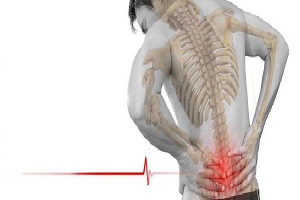 بیرون زدگی دیسک کمر در کمین آقایان