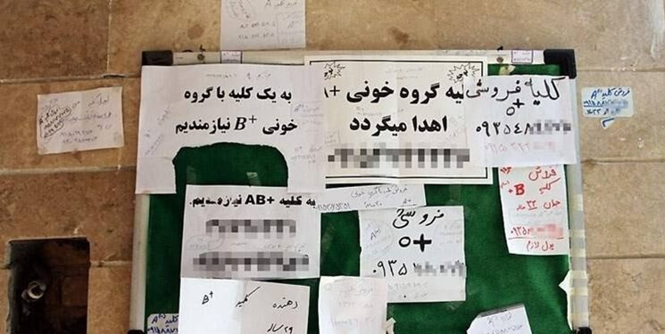 دلالی با جان انسان‌ها/ جای خالی قانون در زمینه پیوند اعضای بدن انسان